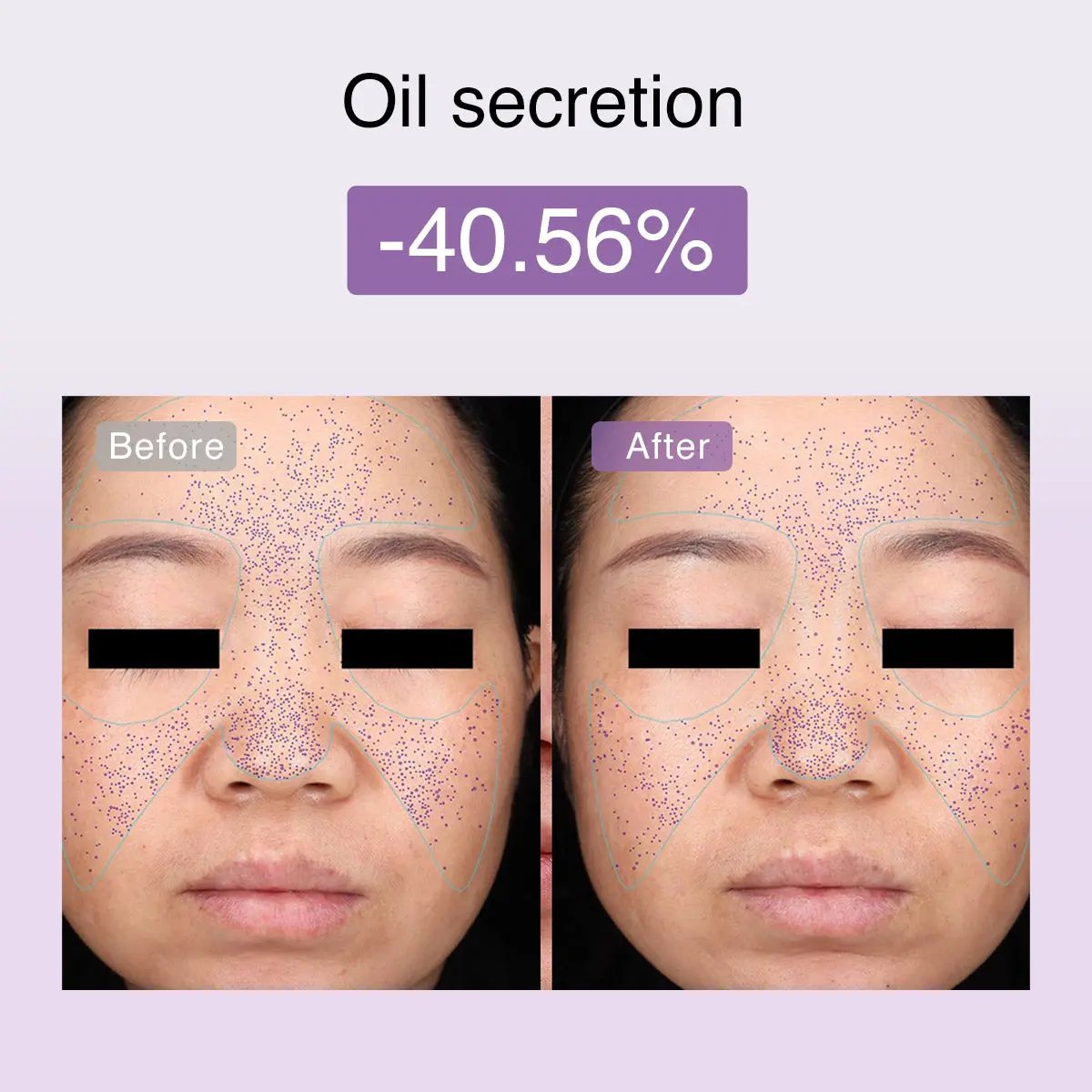 DermRays FusionGlow Multi-Functional Microcurrent Facial Toning Device DermRays DermRays