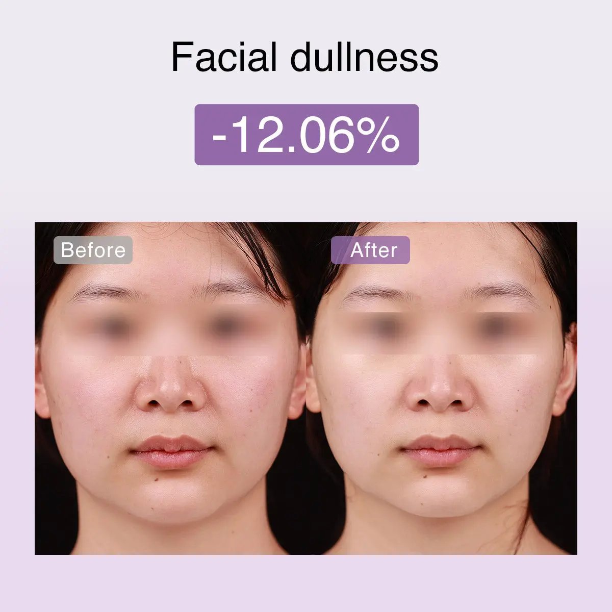 DermRays FusionGlow Multi-Functional Microcurrent Facial Toning Device DermRays