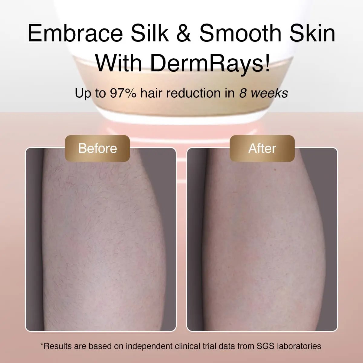 DermRays V4S Diode Laser Hair Removal, 810nm, Specifically For Sensitive Skin Dermrays DermRays